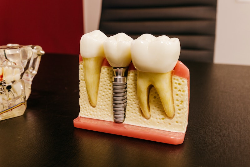 Nova eina Garantia d'Implants